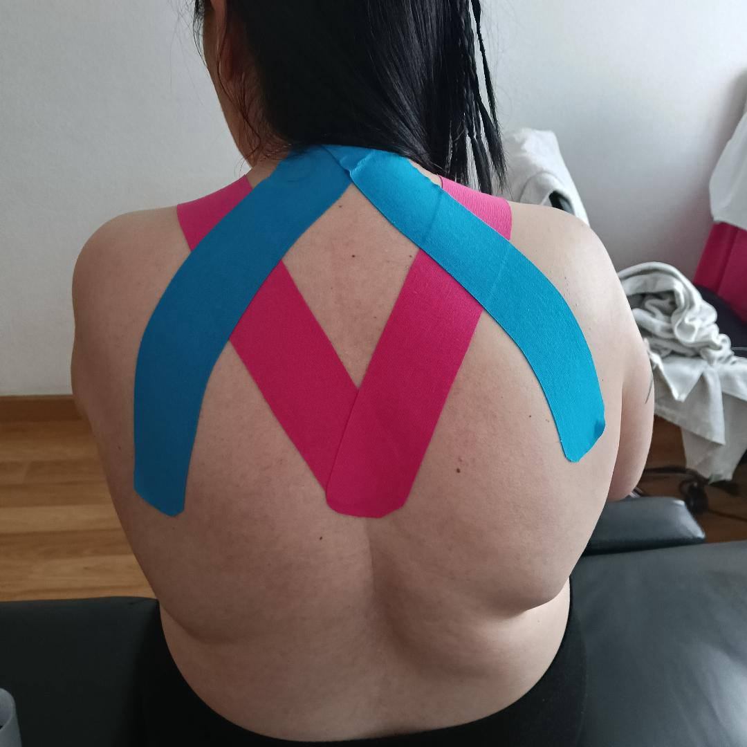 Vendaje neuromuscular en hombros y espalda